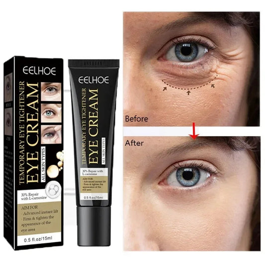 Anti-Wrinkle Eye Cream - Reduces Eye Bags, Puffiness, Lifts & Firms