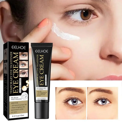 Anti-Wrinkle Eye Cream - Reduces Eye Bags, Puffiness, Lifts & Firms